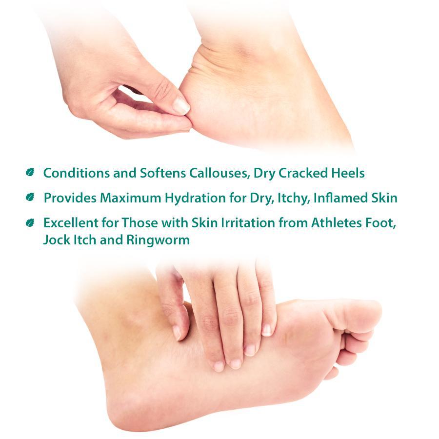 Tea Tree Oil Foot & Body Cream